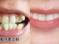 牙齿稀疏的女人吃哈密瓜,焕发迷人笑容的秘密