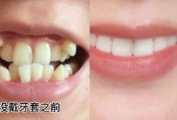 牙齿稀疏的女人吃哈密瓜,焕发迷人笑容的秘密
