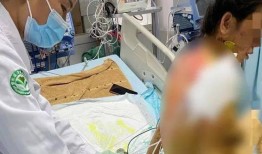 吃哈密瓜住icu,哈密瓜诱惑下的ICU奇遇记